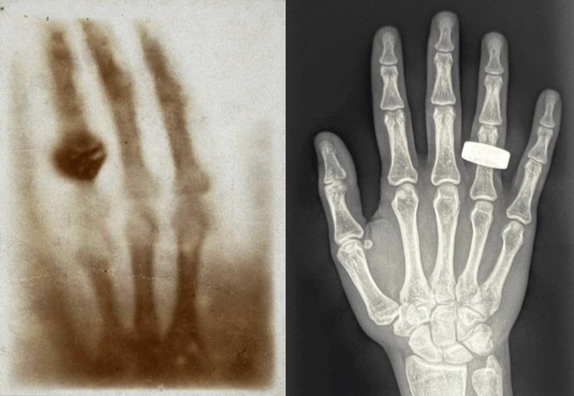 from-earth-to-orbit-the-first-x-ray-in-space-marks-a-full-circle-moment-in-radiology