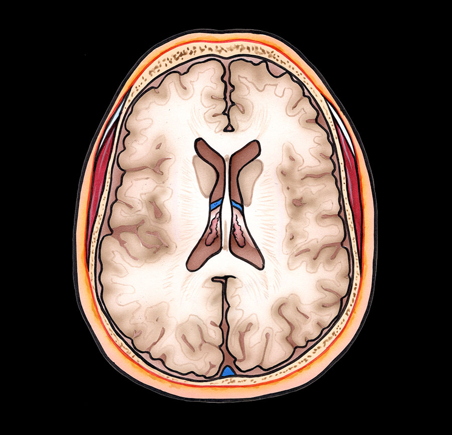 mri mastery series brain anatomy