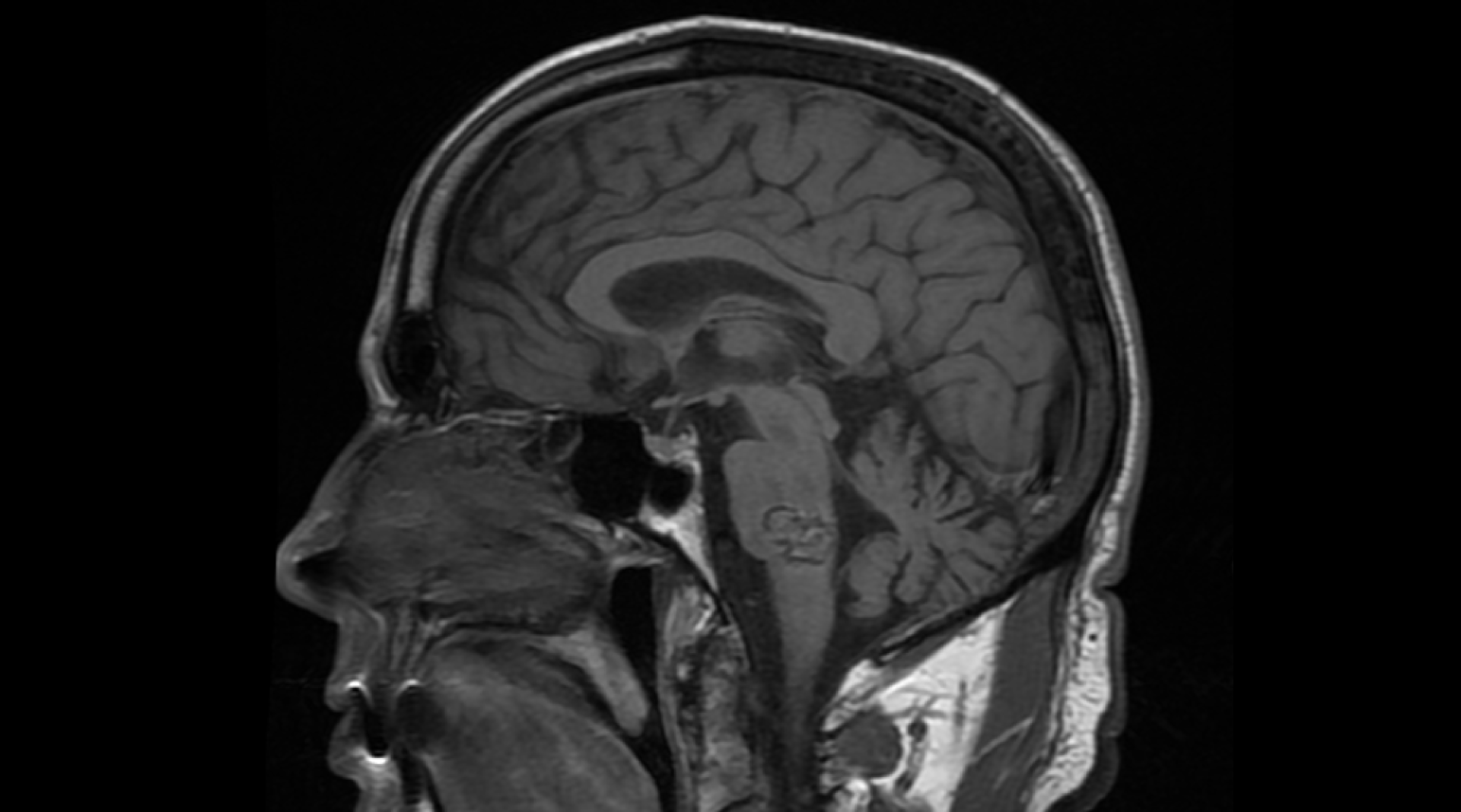review toronto neuro diagnostic case